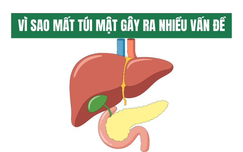 VI SAO MAT TUI MAT GAY RA NHIEU VAN DE